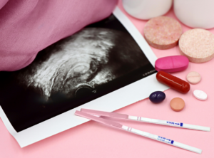 Ultraschallbild mit Schwangerschaftstest und Pillen