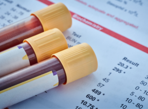 Bluttest mit Röhrchen voller abgenommenen Blut 