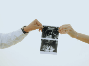 Paar hält Ultraschallbild mit jeweils einer Hand in die Kamera 